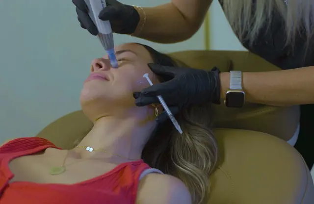 Dermal filler treatment