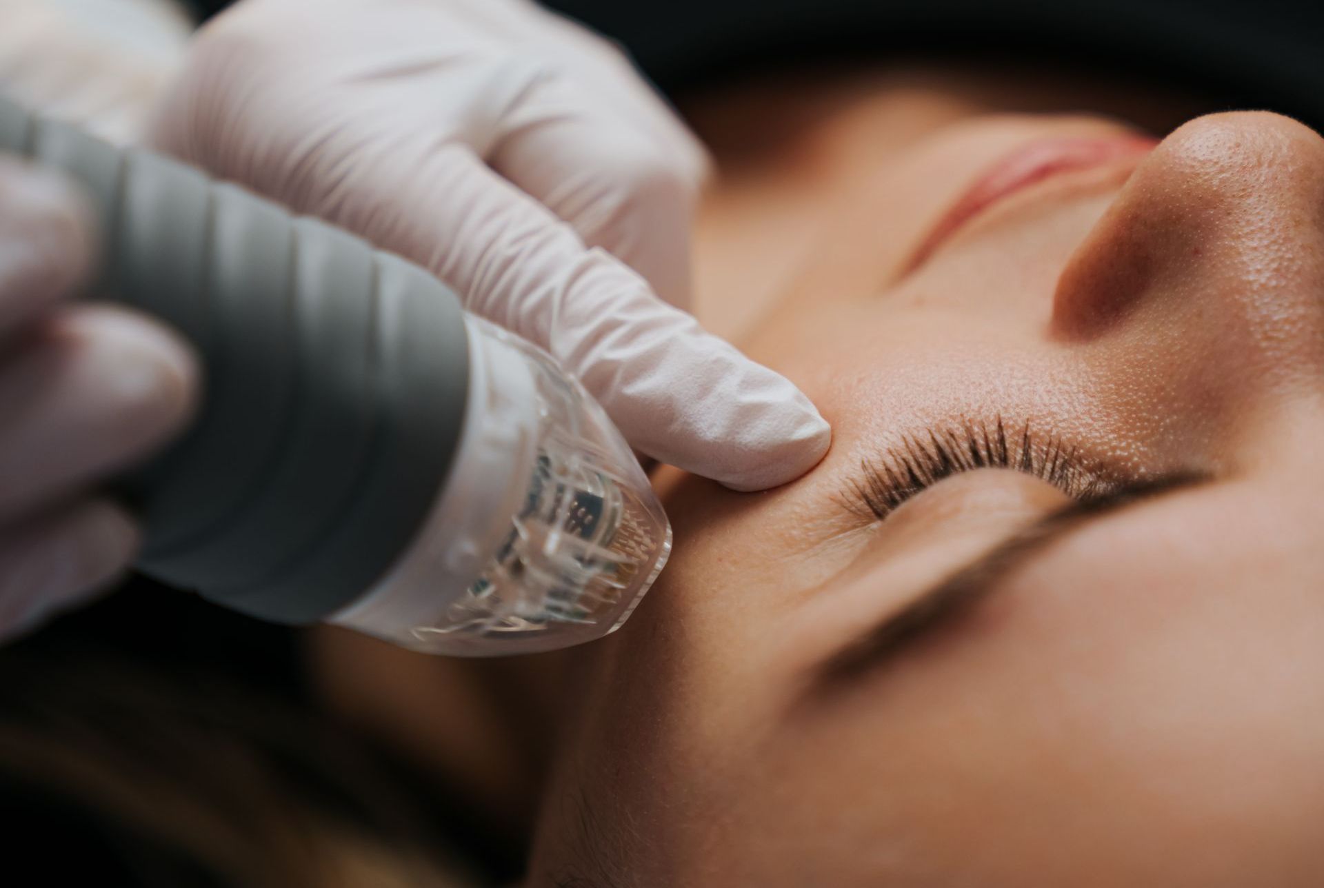 Advanced aesthetic treatment at Glow Beauty Lab Med Spa in Carolina Forest